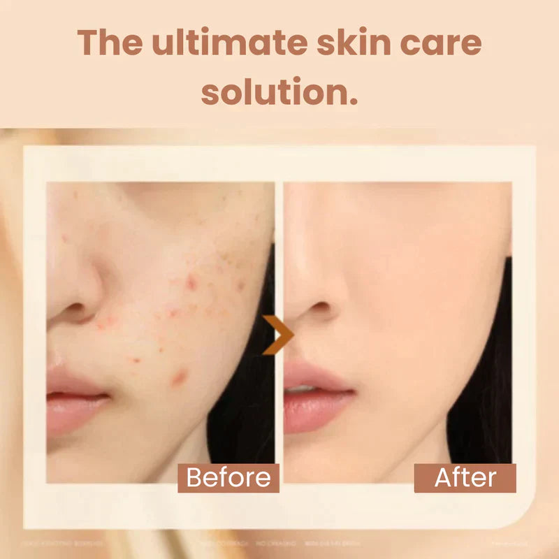 π₯New Year Special 49% OFFπ₯2 in 1 - Foundation + Anti-Wrinkle Concealer