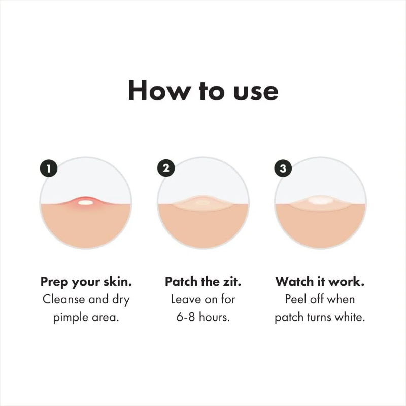 🔥New Arrival 50%OFF💥Hydrocolloid acne patch that shrinks pimples and whiteheads with a single use