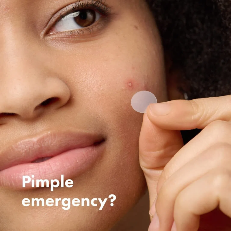 🔥New Arrival 50%OFF💥Hydrocolloid acne patch that shrinks pimples and whiteheads with a single use