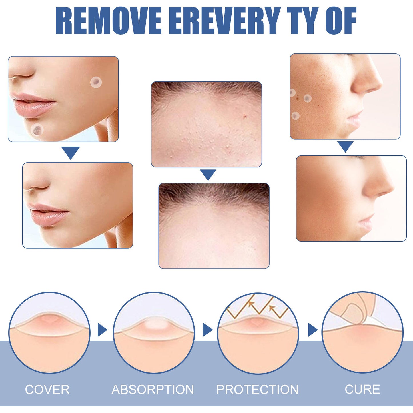 🌈 LAST DAY SALE-50% OFF 🔥Wart removal patch, strong skin care removal patch - 144 pieces