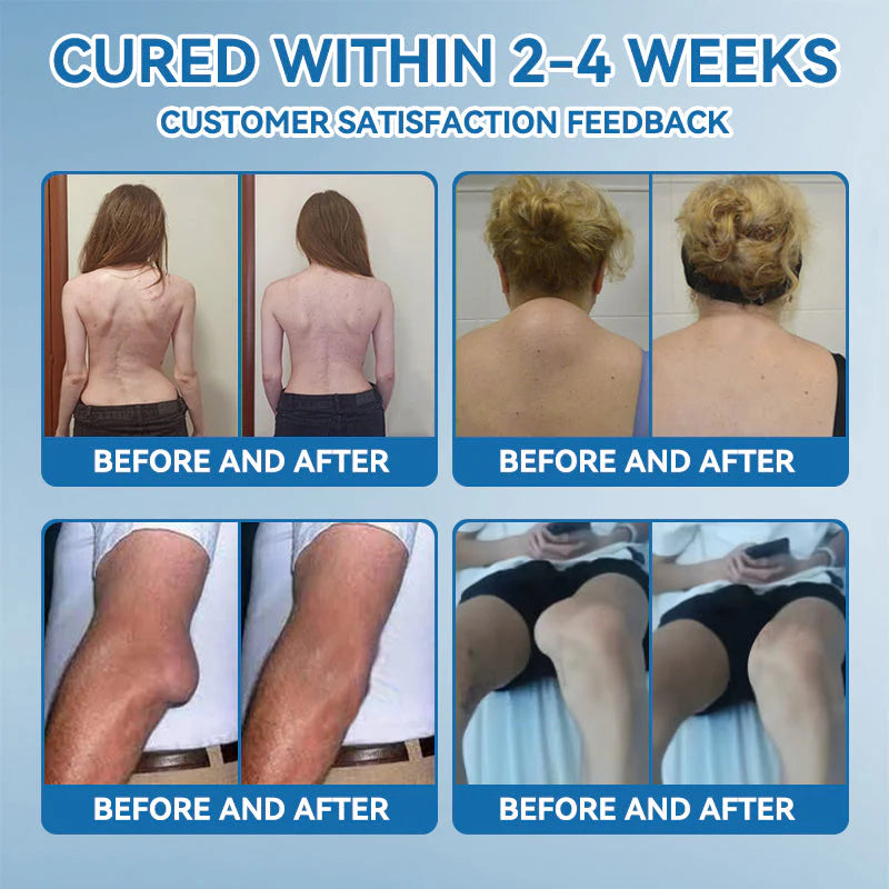 🌈Final 3 Hours: 50% OFF🔥BPC-157 Joint Healing Cream🦴Treats Arthritis, Neuropathy, Rheumatism, Sports Injuries &amp; More👍