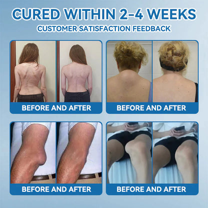 🌈Final 3 Hours: 50% OFF🔥BPC-157 Joint Healing Cream🦴Treats Arthritis, Neuropathy, Rheumatism, Sports Injuries &amp; More👍