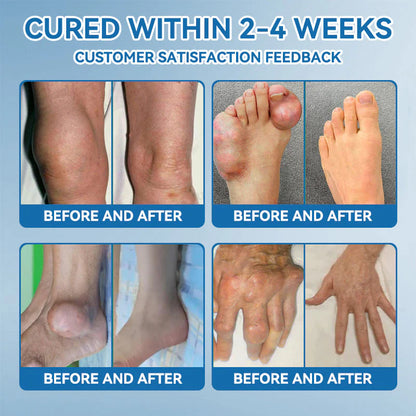 🌈Final 3 Hours: 50% OFF🔥BPC-157 Joint Healing Cream🦴Treats Arthritis, Neuropathy, Rheumatism, Sports Injuries &amp; More👍