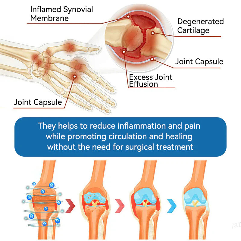 🌈Final 3 Hours: 50% OFF🔥BPC-157 Joint Healing Cream🦴Treats Arthritis, Neuropathy, Rheumatism, Sports Injuries &amp; More👍