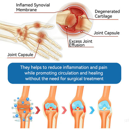 🌈Final 3 Hours: 50% OFF🔥BPC-157 Joint Healing Cream🦴Treats Arthritis, Neuropathy, Rheumatism, Sports Injuries &amp; More👍