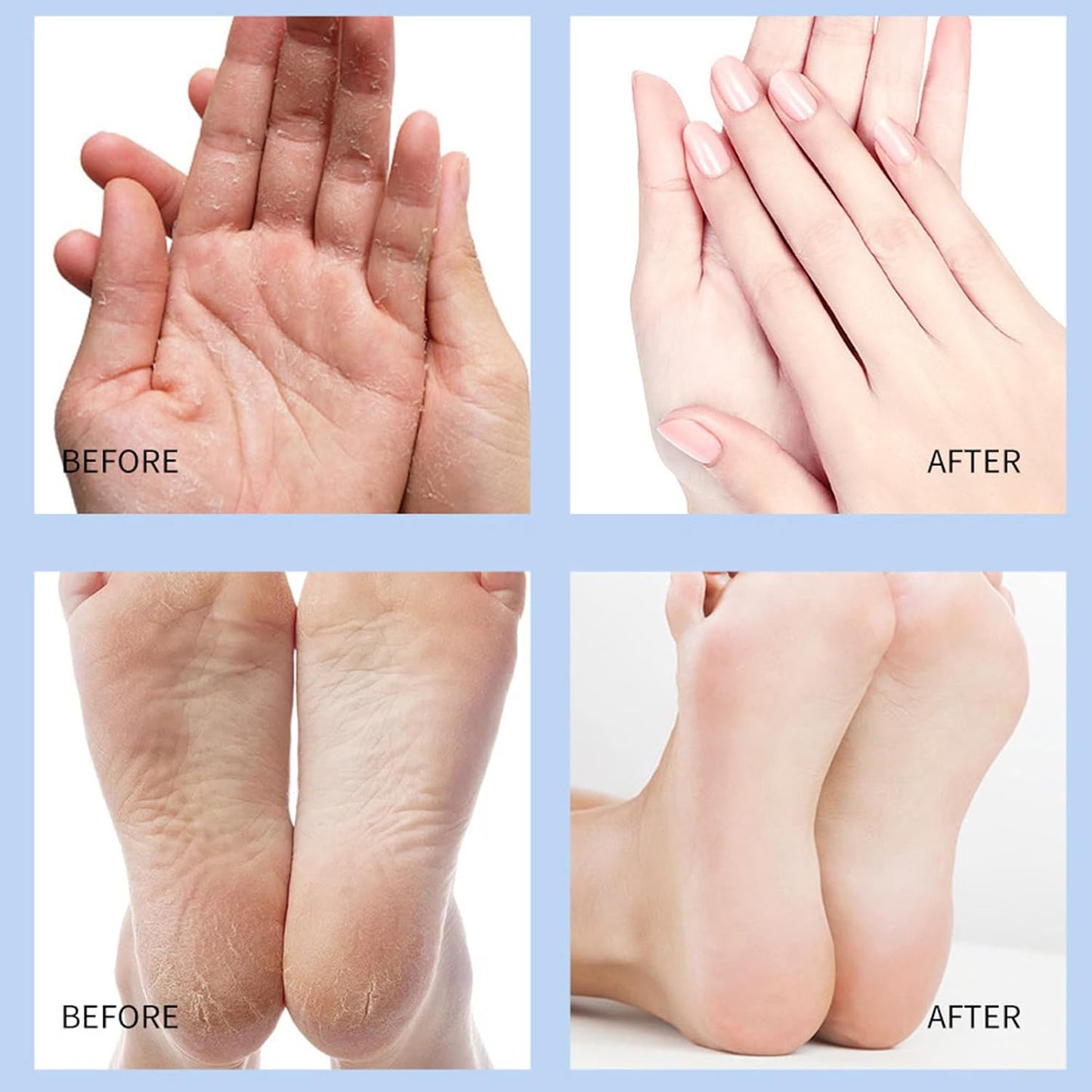 🔥 50% OFF 🔥Anti Cracked Foot Cream For Dry Heels, Remove Dead Skin And Softening Dry Skin