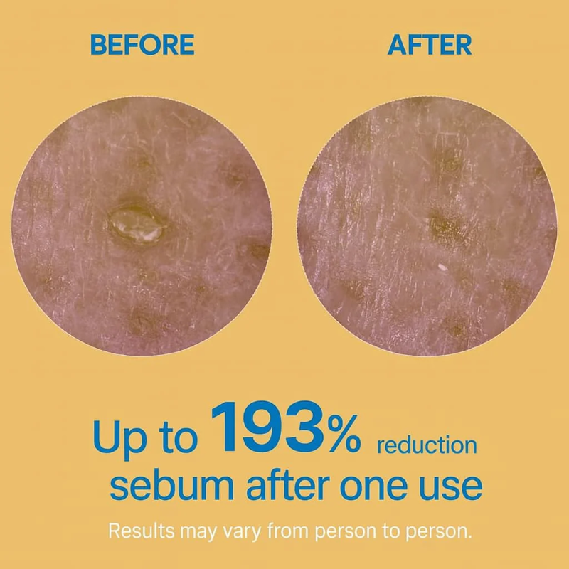 Final 3 Hours: 50% OFF 🔥 Gentle Exfoliator Glow Rice Ampoule