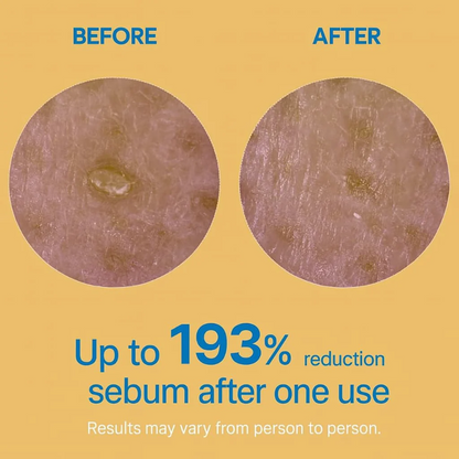 Final 3 Hours: 50% OFF 🔥 Gentle Exfoliator Glow Rice Ampoule