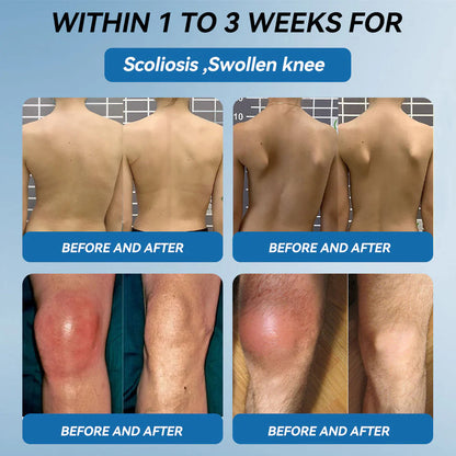 🌈Final 3 Hours: 50% OFF🔥BPC-157 Joint Healing Cream🦴Treats Arthritis, Neuropathy, Rheumatism, Sports Injuries &amp; More👍