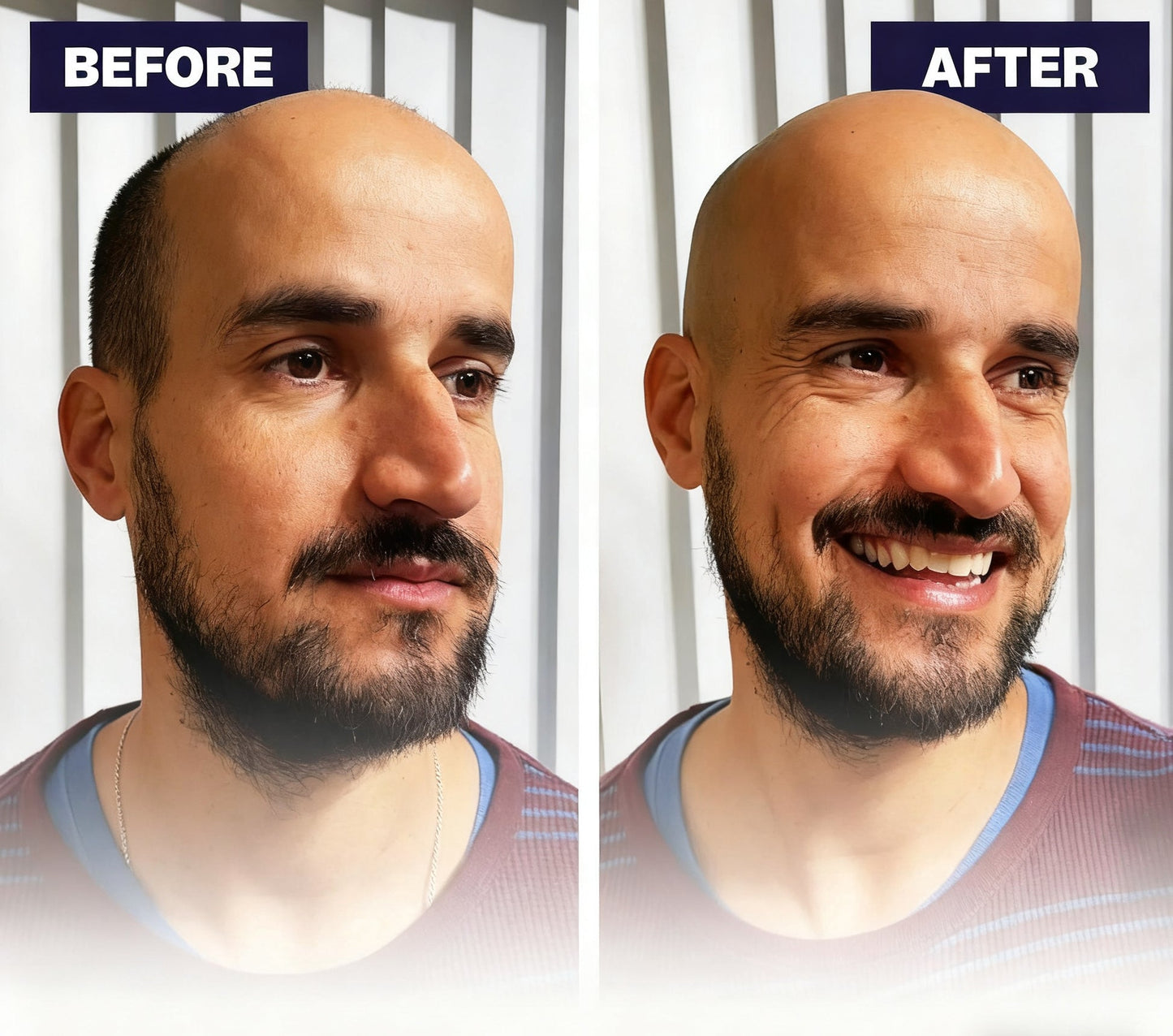 🌈Final 3 Hours: 50% OFF🔥Effortless Head Shaving: Must-Have Shaver For Bald Guys