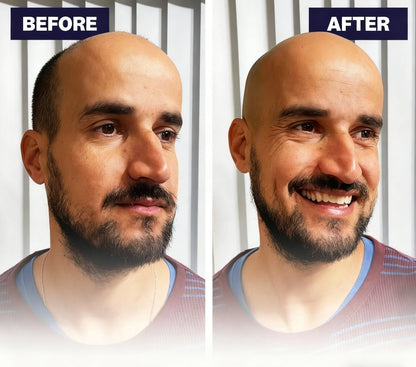🌈Final 3 Hours: 50% OFF🔥Effortless Head Shaving: Must-Have Shaver For Bald Guys
