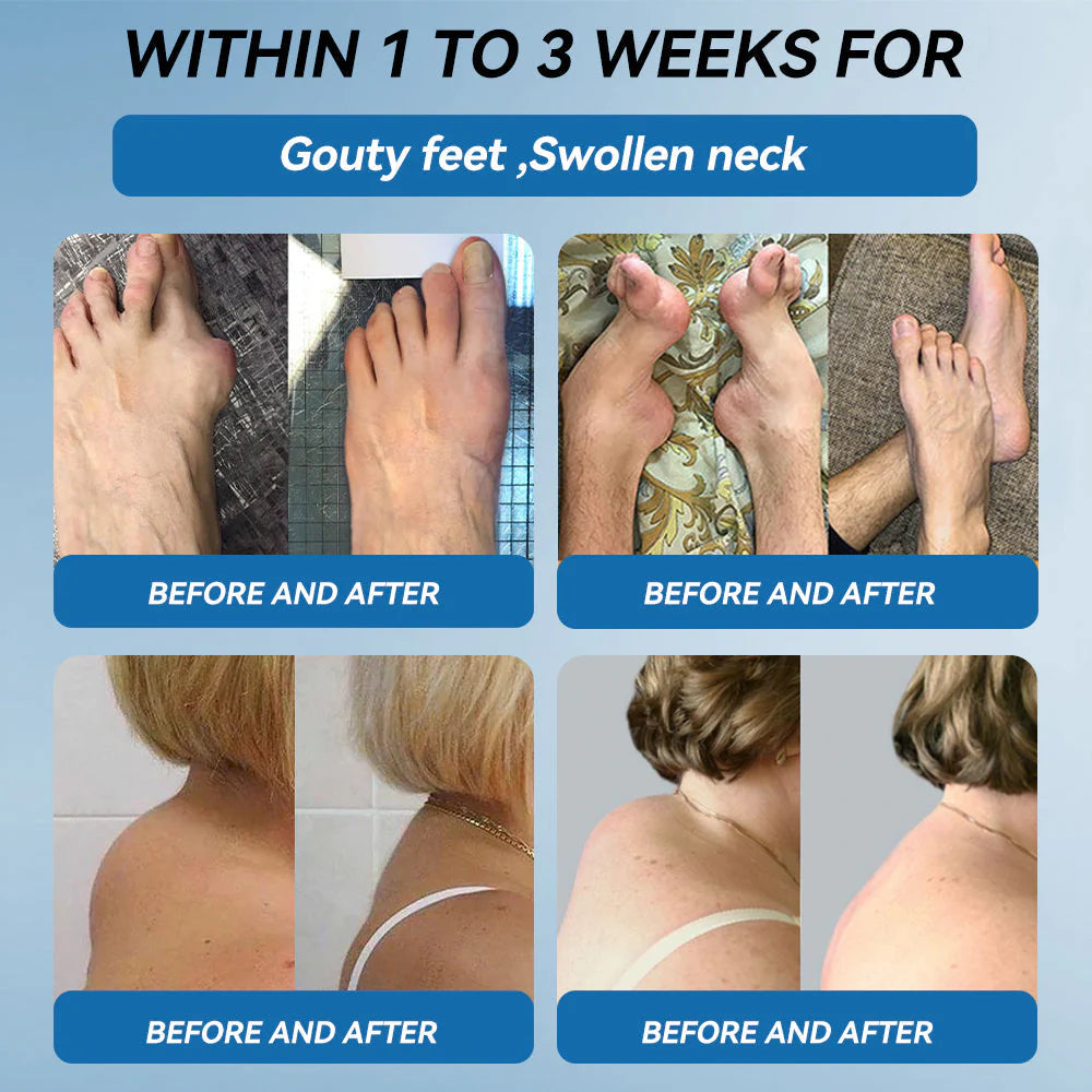 🌈Final 3 Hours: 50% OFF🔥BPC-157 Joint Healing Cream🦴Treats Arthritis, Neuropathy, Rheumatism, Sports Injuries &amp; More👍