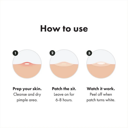 🔥New Arrival 50%OFF💥Hydrocolloid acne patch that shrinks pimples and whiteheads with a single use