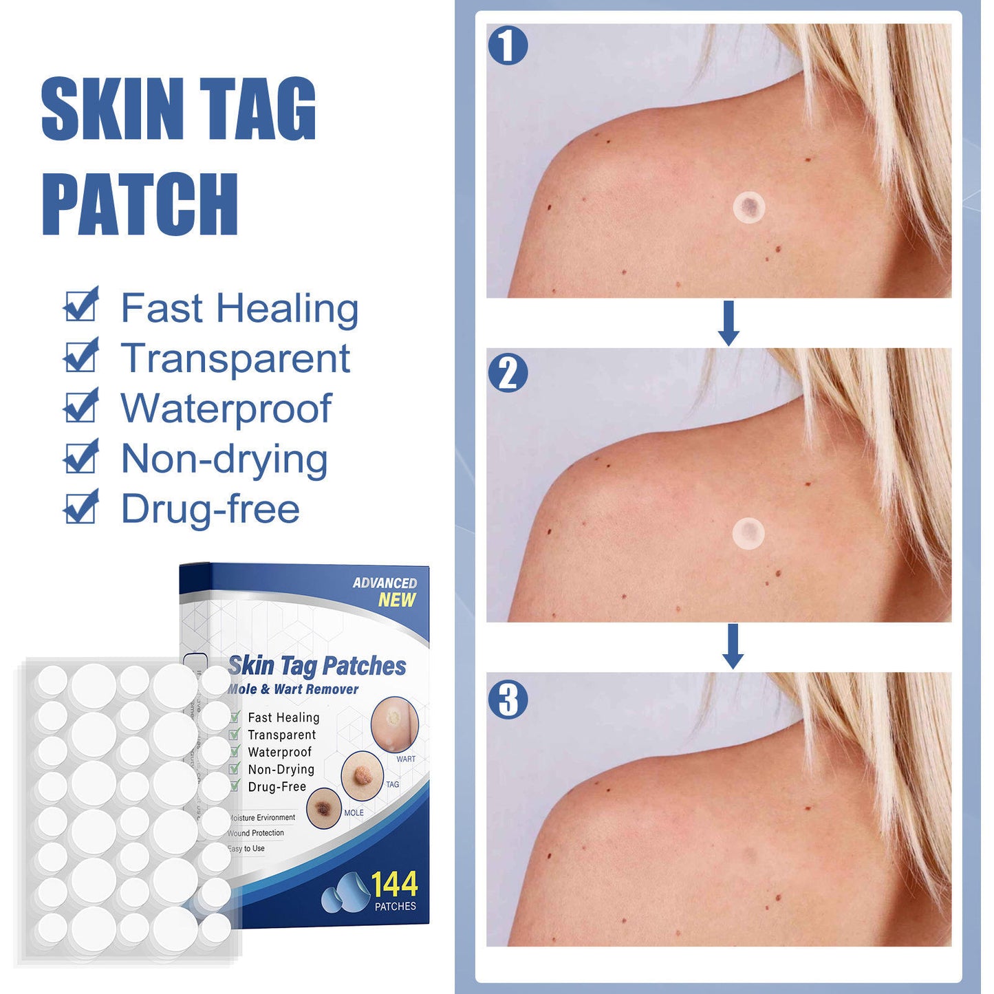 🌈 LAST DAY SALE-50% OFF 🔥Wart removal patch, strong skin care removal patch - 144 pieces
