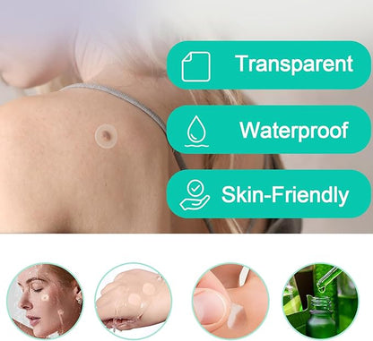 🌈 LAST DAY SALE-50% OFF 🔥Wart removal patch, strong skin care removal patch - 144 pieces