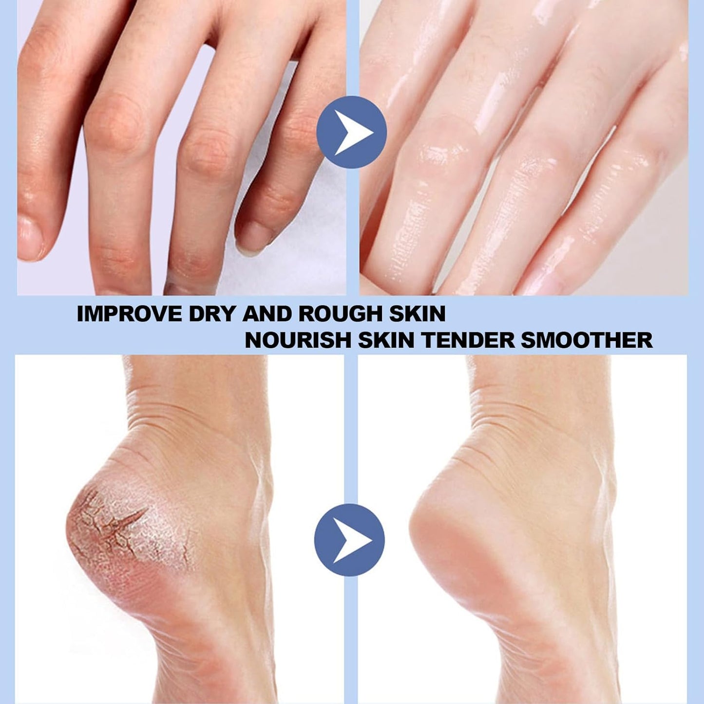🔥 50% OFF 🔥Anti Cracked Foot Cream For Dry Heels, Remove Dead Skin And Softening Dry Skin