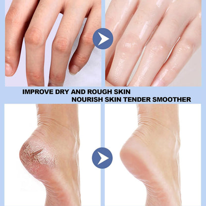 🔥 50% OFF 🔥Anti Cracked Foot Cream For Dry Heels, Remove Dead Skin And Softening Dry Skin