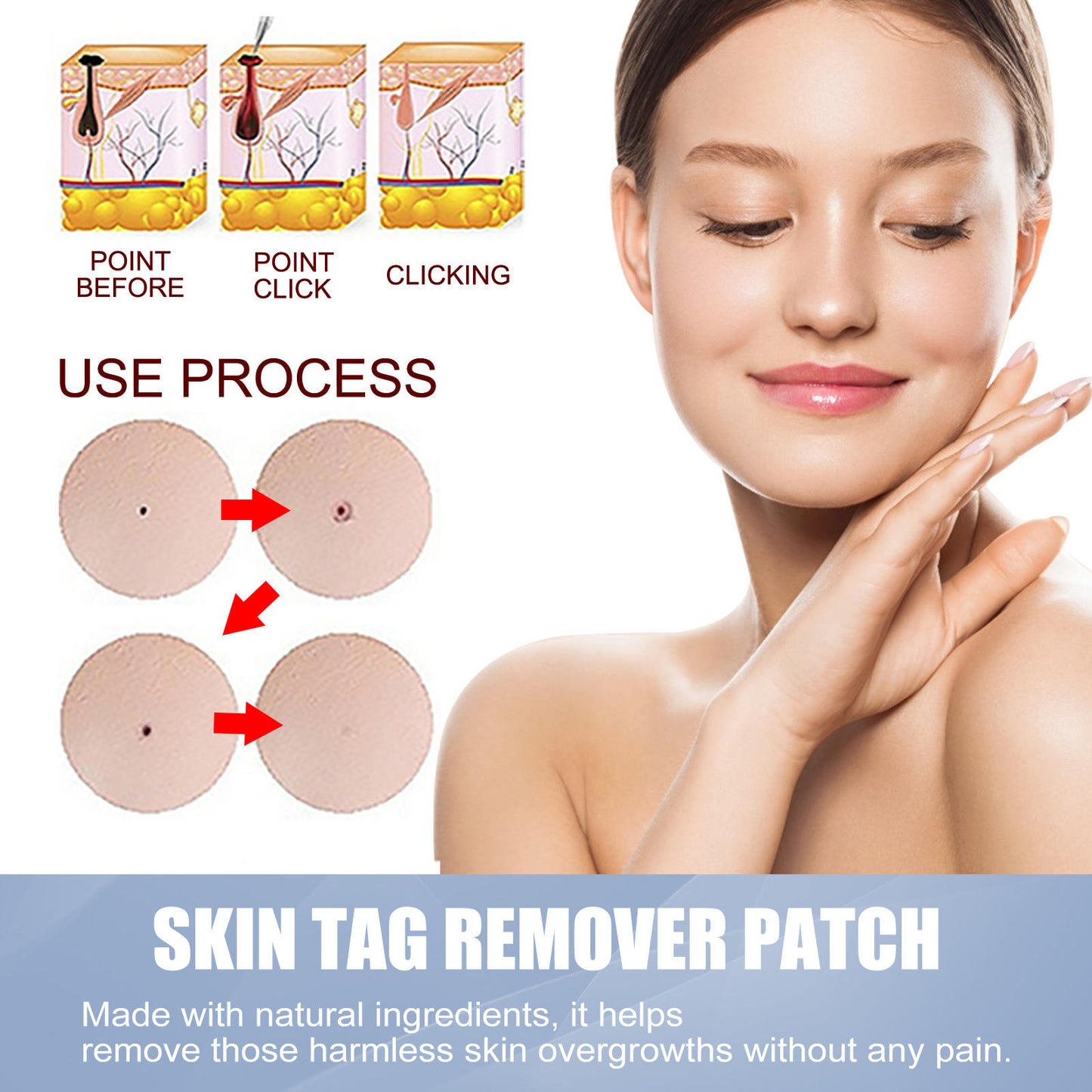 🌈 LAST DAY SALE-50% OFF 🔥Wart removal patch, strong skin care removal patch - 144 pieces