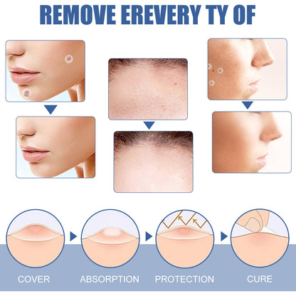 🌈 LAST DAY SALE-50% OFF 🔥Wart removal patch, strong skin care removal patch - 144 pieces